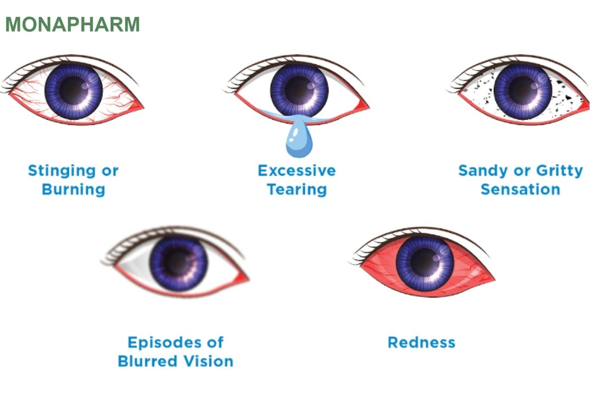 Biểu hiện của bệnh khô mắt