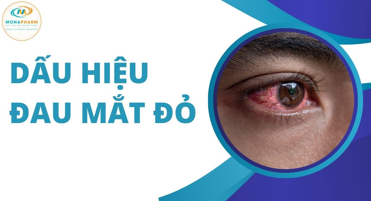 Dấu hiệu đau mắt đỏ