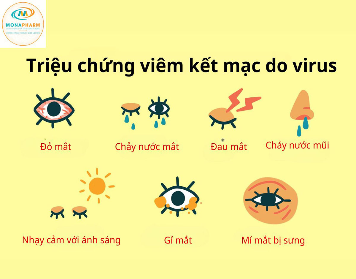 Triệu chứng viêm kết mạc do virus