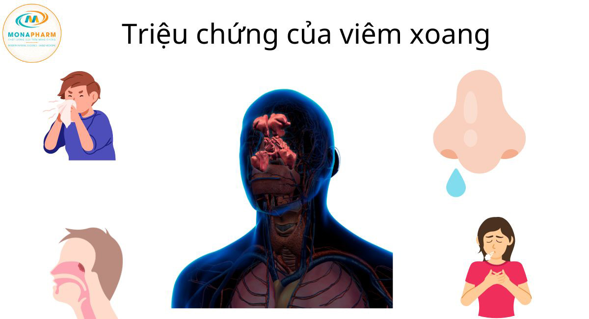 Triệu chứng của viêm xoang